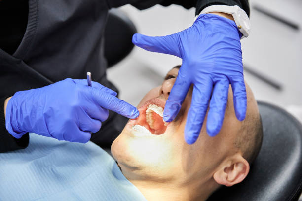 Best Urgent Care for Lost Fillings or Crowns in Kent, OH
